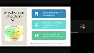 Silver Diamine Fluoride SDF in Pediatric Dentistry