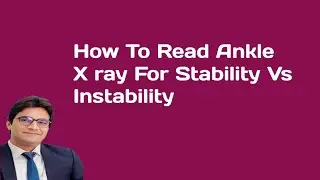 How to check Ankle Stability On X ray