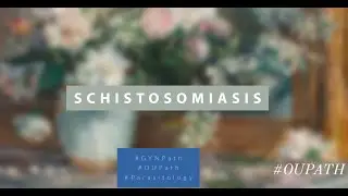 Schistosomiasis- Surg Path