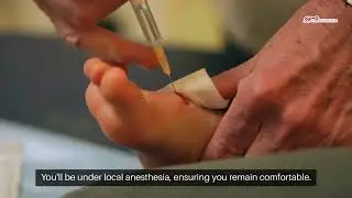 Venous Ablation for Peripheral Disease in Waco, TX: A Complete Guide