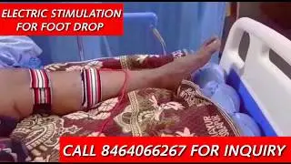 #inpatient #outpatient #physiotherapy #rehabilitation #HYDERABAD #electric stimulation #foot drop