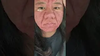 Woman's face completely changes during pregnancy