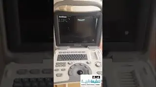 طريقة العمل علئ جهاز سونار سنسكوب A5وكيفية اخذ القياسات ومعرفة عمر الجنين