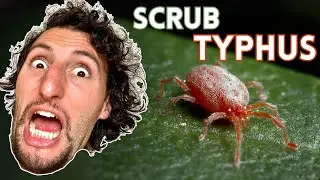 Scrub Typhus: Diagnosis & Management