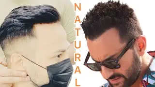 Saif Ali khan Look with Hair Patch | frontline hair patch #celebrity #hairpatch #shorts #saifalikhan