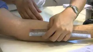 Allergy test, skin  test,  skin prick test, allergy test hong kong - CAAC