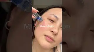 Micro Infusion skincare kit Qure #glowyskin #microneedling #skincaretool #skincareugc #skincarekit