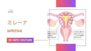 #ミレーナ - Mirena  | 基本情報, 効能, 注意すべき, 副作用, 用法・用量| レボノルゲストレル