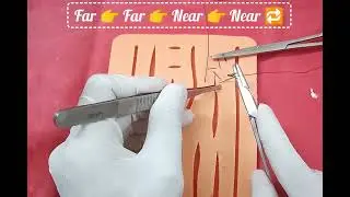 Непрерывное ушивание двойной петли &mdash; техника ушивания прямой мышцы живота