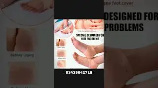 pain relief socks 🧦. Anti crack silicone heel socks 🧦 #likeandsubscribe#1millionviews #home #support