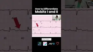 What's the difference between Mobitz Type 1 and Type 2 on an ECG?  〰️🫀〰️
