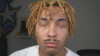 I CANT SEE!