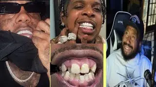 Money or Teeth? Can't do Both! Akademiks reacts to Famous Dex popping out w new Teeth!