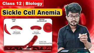 Sickle Cell Anemia Class 12 Biology Ch 04 Principles of inheritance and variation Nikhil Pandey Sir