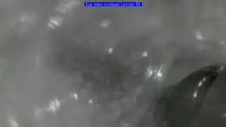 infrared insect microscopy (center) bug 1a
