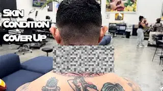 Covering My Skin Condition With A Tattoo #life #art #tattoo