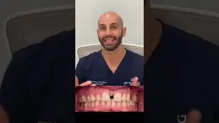 How We Close A Large Front Gap With Invisalign