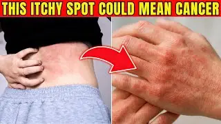 This itchy spot means 99% cancer in seniors if ignored Early warning signs older adults must know