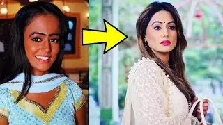 10 Plastic Surgery of TV Actresses Before and After | SHOCKING