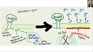 Cancer Y fat promotes & starch prevents it