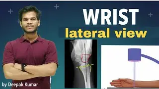 Wrist Lateral view l colle's Fracture lSmith's Fracture l Bartsons's Fracture l #deepmedskills #drt