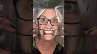 Full mouth transformation with dental implants under general anesthesia.