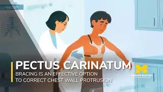 Как медицина штата Мичиган лечит Pectus Carinatum