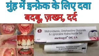 Metrogyl DG LA Gel |metronidazole and chlorhexidine gel |@MediReview