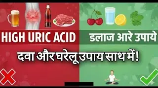 High Uric Acid Treatment &ndash; ​​Medicine + Home Remedies | Symptoms, Diet & Ayurvedic Cure Explained