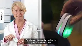 Onychom - Antifungal Laser Device - CWAF1