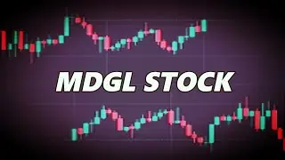 MDGL Stock Market Trading and Its Technical analysis - Madrigal Pharmaceuticals Stock