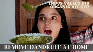 Indus Valley Bio Organic DIY Dandruff Clarifying Hair Pack | Remove Dandruff In 1 Day | And More!