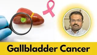 Gallbladder Cancer | Is Gallbladder Cancer Different from other Cancer Types? | Dr Maran