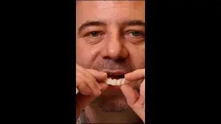 affordable alternative to veneer.mov