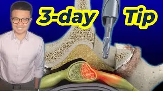 Physical Therapy after Lumbar Laminectomy: 0-3  Day Secrets for Success