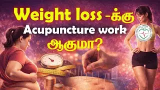 Diet இல்லாம Weight Loss-க்கு Acupuncture Help பண்ணுமா? Acupuncture Weight Loss Explained | Tamil