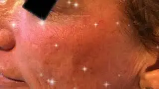 The MedSpa at Raleigh Plastic Surgery Center