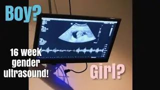 16 week gender ultrasound of our rainbow baby - September 2, 2020