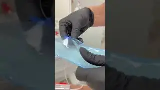 Внутривенная лазерная терапия