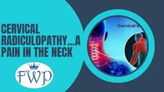 Neck Pain Radiating Down the Arm with Hand Weakness?...This Could be Why