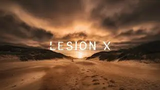 Memories &ndash; Lesion X - NO COPYRIGHT MUSIC