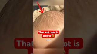 Why You Shouldn&rsquo;t Touch a Baby&rsquo;s Skull
