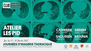 Atelier sur les pneumopathies interstitielles diffuses PID