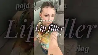 lip filler vlog #cz #lipfiller #lips #makeup #vlog #makeup