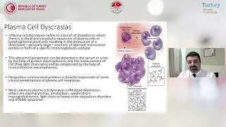 Plasma Cell Dyscrasias
