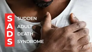 Sudden adult death syndrome has no correlation with COVID-19: Expert