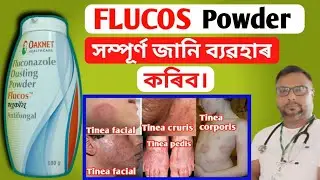 Flucos powder | flucos dusting powder review | flucos powder uses in Assamese | @health tips ikbal