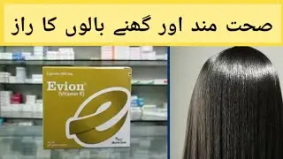 Evion 600mg (Vitamin E) Capsule Benefits For Hair || Evion capsule Ke Balo Ke Liye Fayde ||