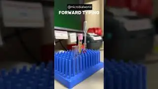 Forward & Reverse Typing| Blood Grouping #love   #shorts #trending #youtubeshorts #microbialworld