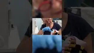 Уход за летучими мышами в городе #реабилитациядикихживотных #уходзадидикимиживотными #неделябатов